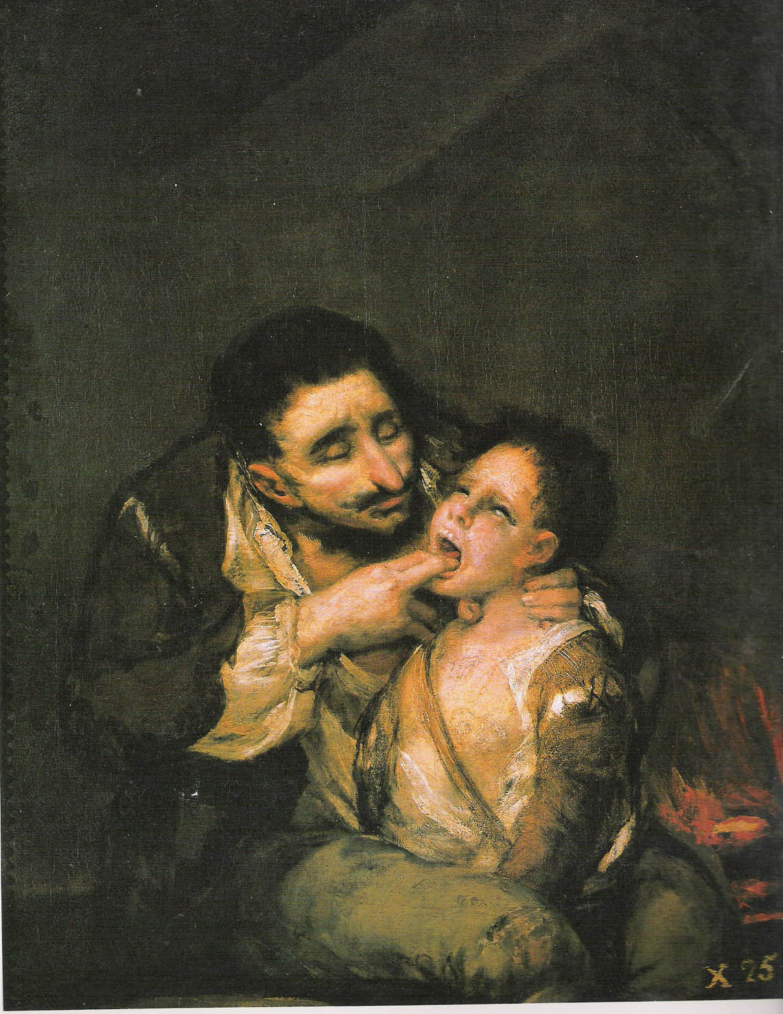 Difteria. Francisco Goya, 1812